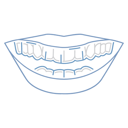 周囲に気づかれずに矯正したい