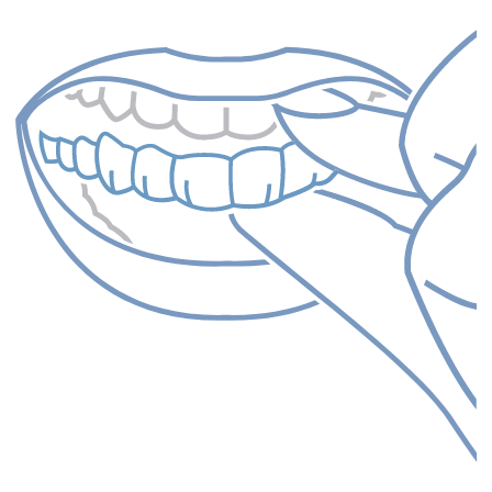 装置の取り外しができる柔軟な治療を希望している